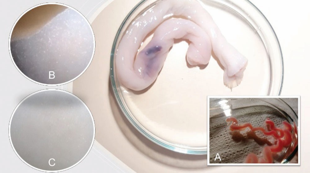 Tissue samples derived from the human umbilical artery, 