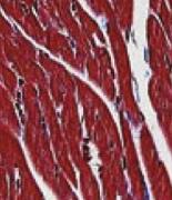 Pulmonary artery fibrosis. (Bao,2022)