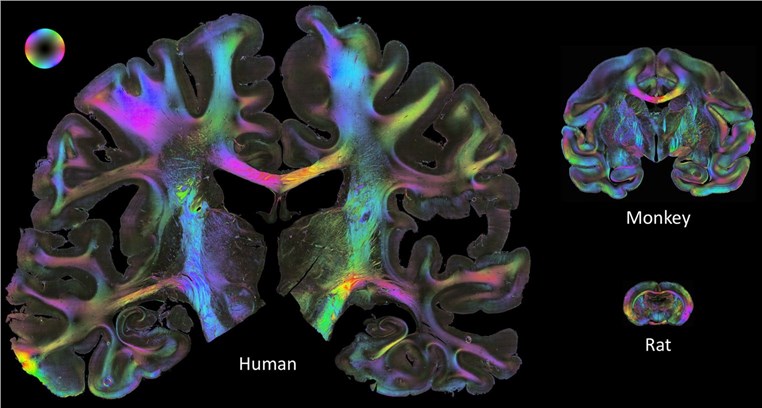 Coronal sections from a human brain, a vervet (monkey) and a rat brain.