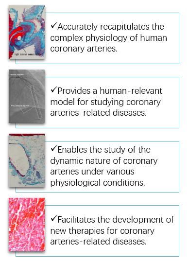 Conveniences and advantages of the novel Human coronary Arteries Model (Yu, 2013). loading=