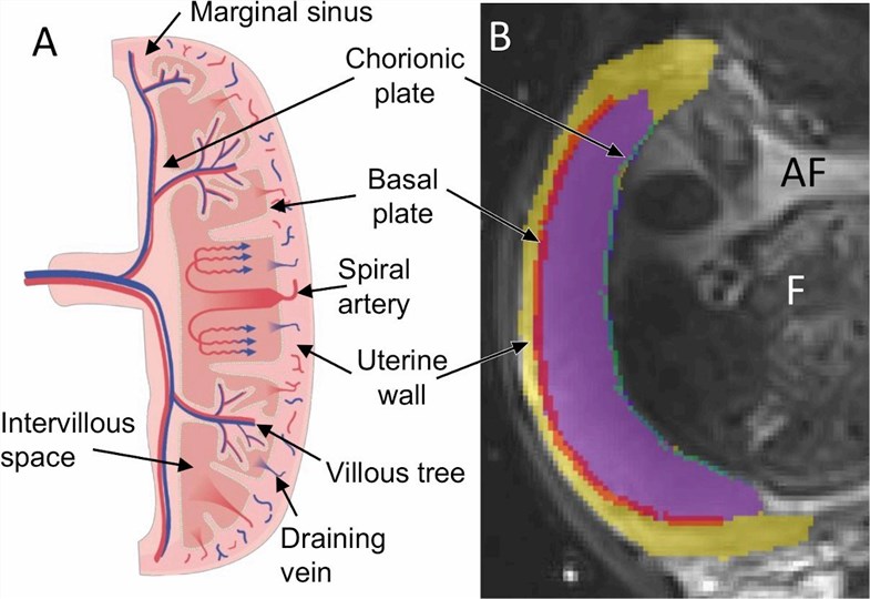 Schematic showing blood movement through the placenta. 