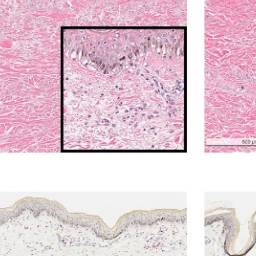 Fig 1. Hydrocortisone reduces inflammation and epidermal damage.