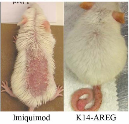Fig 2. Psoriasiform phenotypes in the laboratory mouse. (Swindell, et al., 2011)