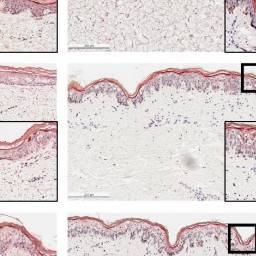 Fig 3. Assessment of epidermal barrier protein expression in the inflammatory skin models. (Wang, et al., 2023)
