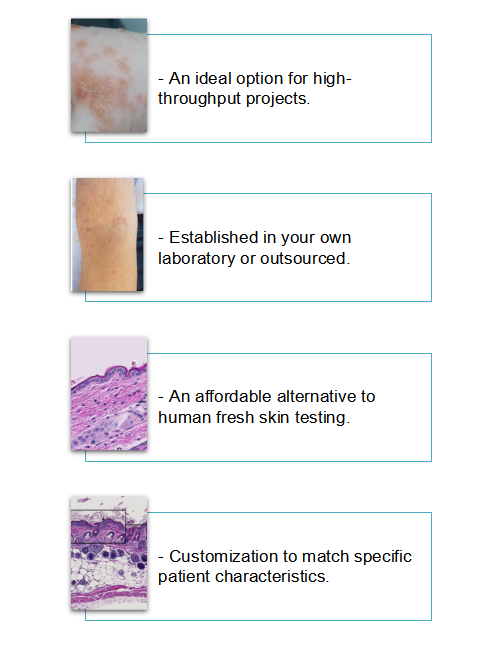 Schematic of human skin tissue.