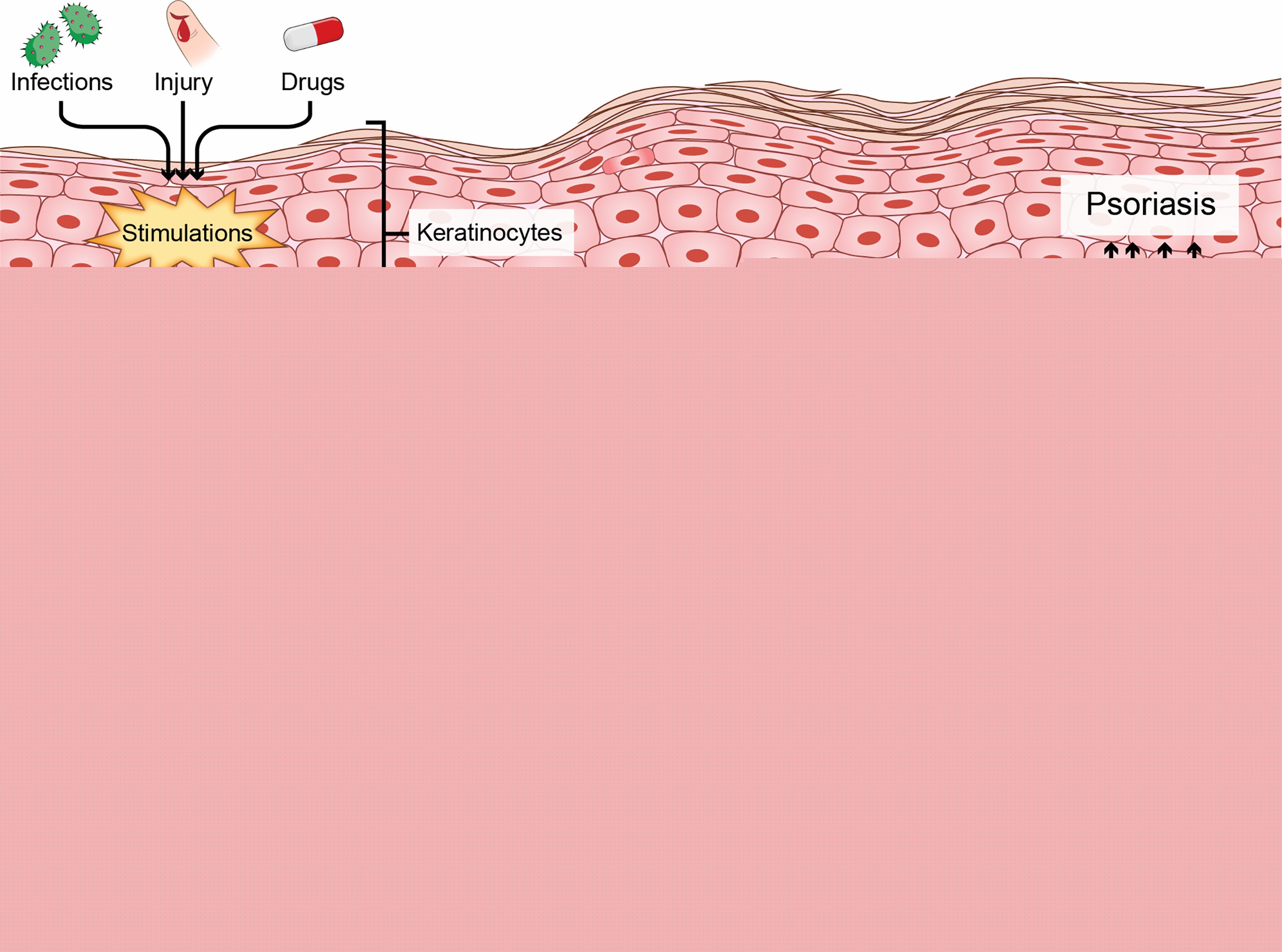 Fig 1. Immune dysfunction of psoriasis.
