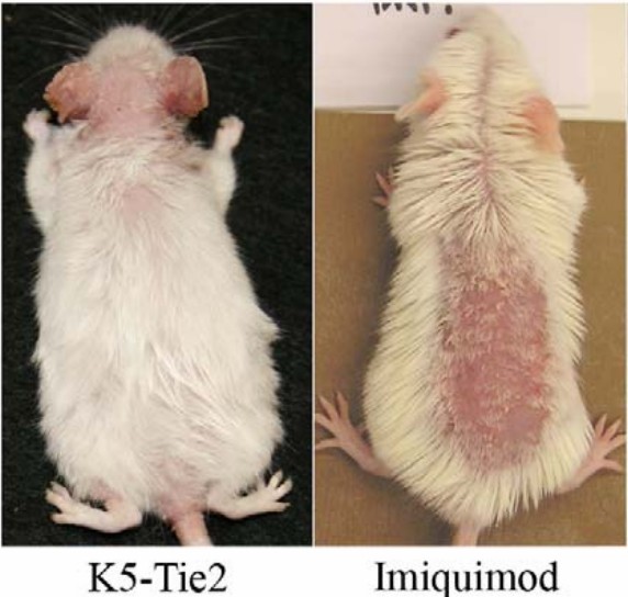 Fig 2. Psoriasiform phenotypes in the laboratory mouse. (Swindell, et al., 2011)