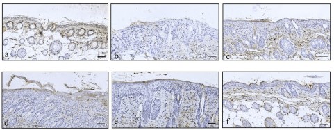 Investigating atopic dermatitis in mice to understand skin dysfunction.