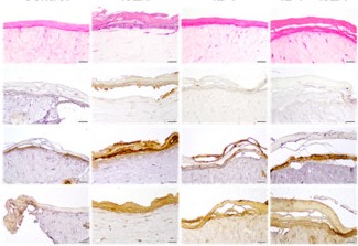 Examining the efficacy of I3LA on a 3D in vitro model of atopic dermatitis.