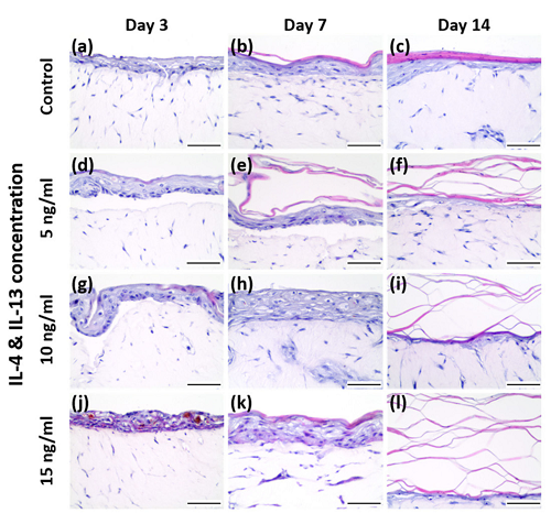 Fig 5. H&E staining of AD-HSE. (Kim, et al., 2022)