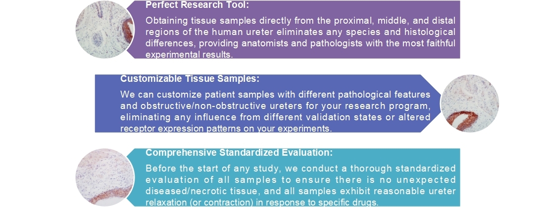 We can provide customers with high-quality in vitro human ureteral models(Oll, 2012).