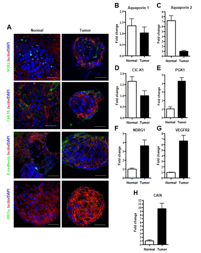 Analysis and description of three-dimensional extracorporeal renal pathology models