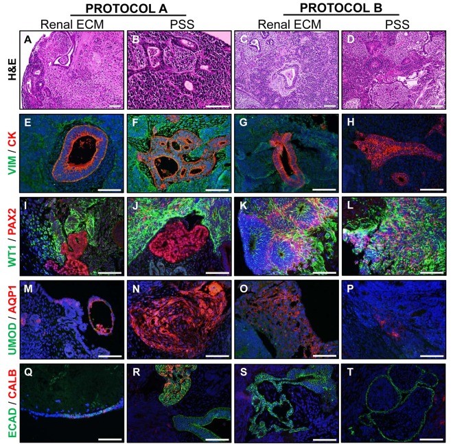 Directed differentiation of human embryonic stem cell towards renal lineage.