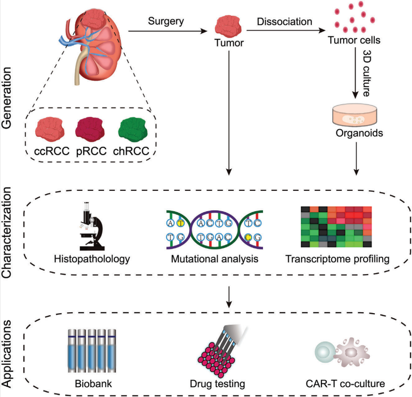 Effective fabrication of three-dimensional renal cell carcinoma models derived from patients.