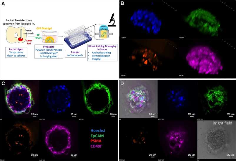 Fig 1. Radical prostatectomy punch biopsies generated PDCO structures ex vivo.