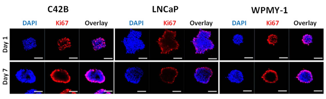 Fig 2. Spheroid images show Ki67 and DAPI staining.