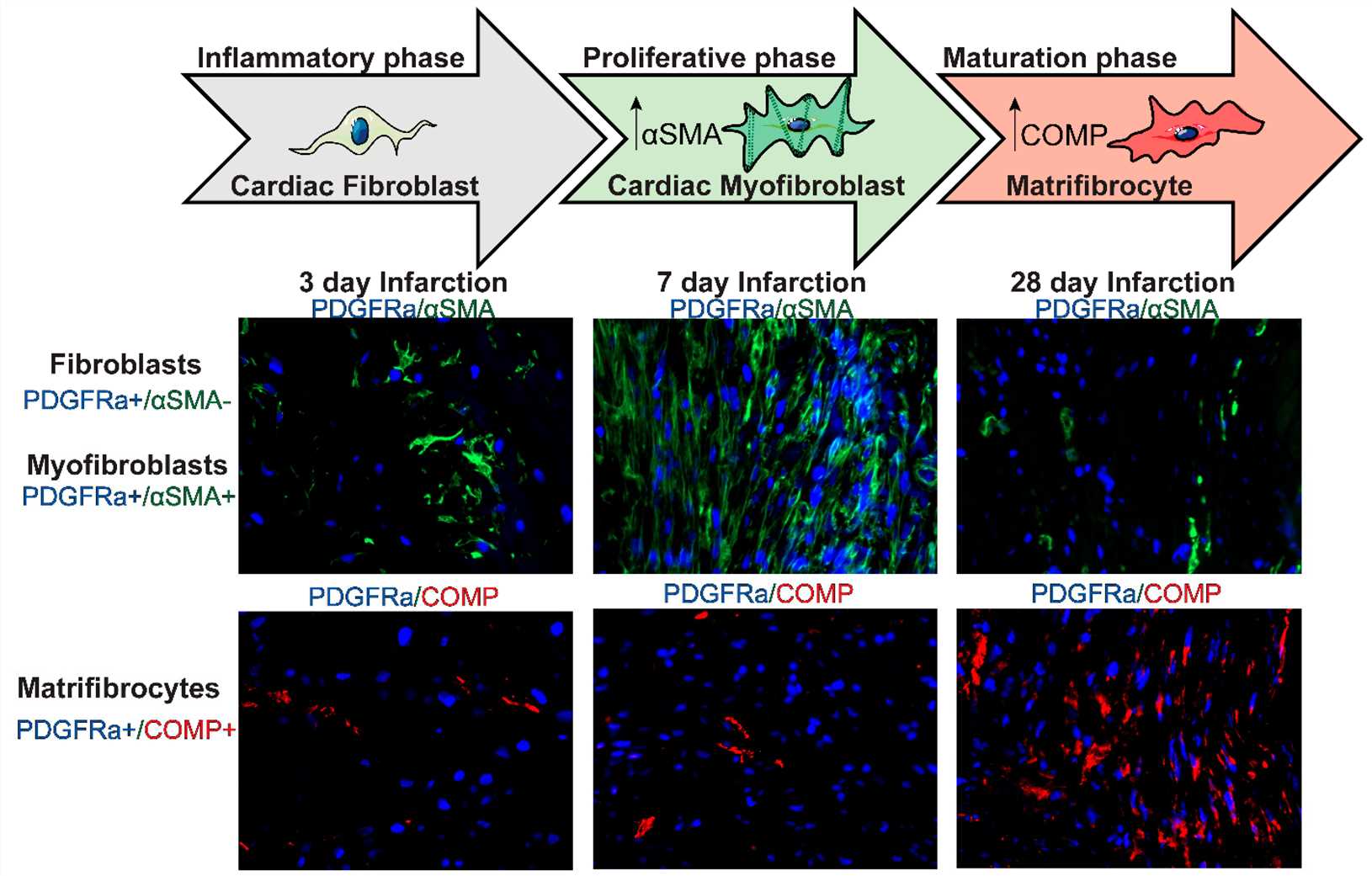 Fig 1. The progression of fibroblast activation.