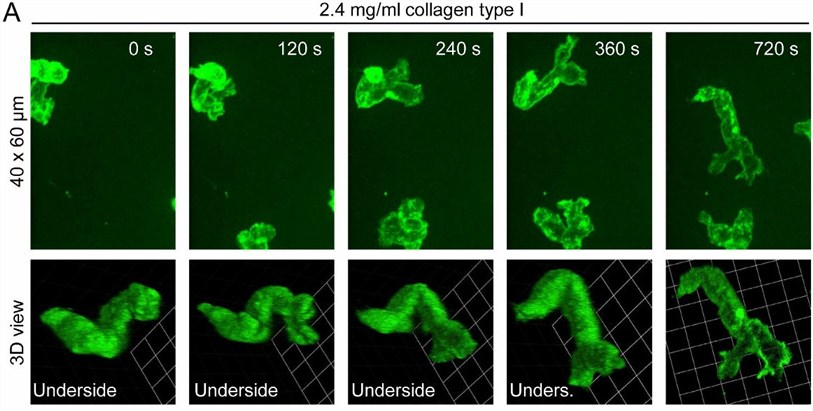 Fig 1. 3D morphology of human monocytes migrating in collagen type 1.