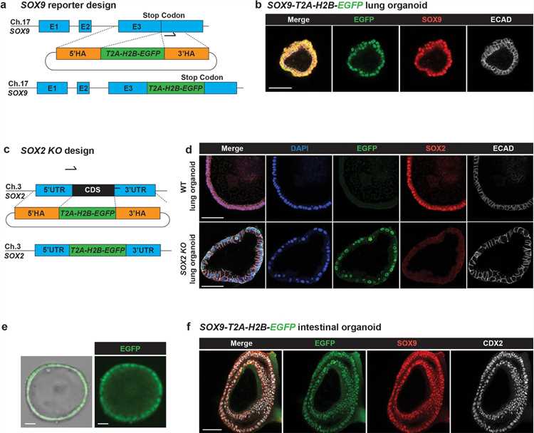 Fig 1. SOX9-targeted organoids retained the potential to differentiate.