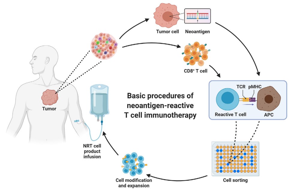 Fig 1. Basic procedures of neoantigen‐reactive T cell immunotherapy