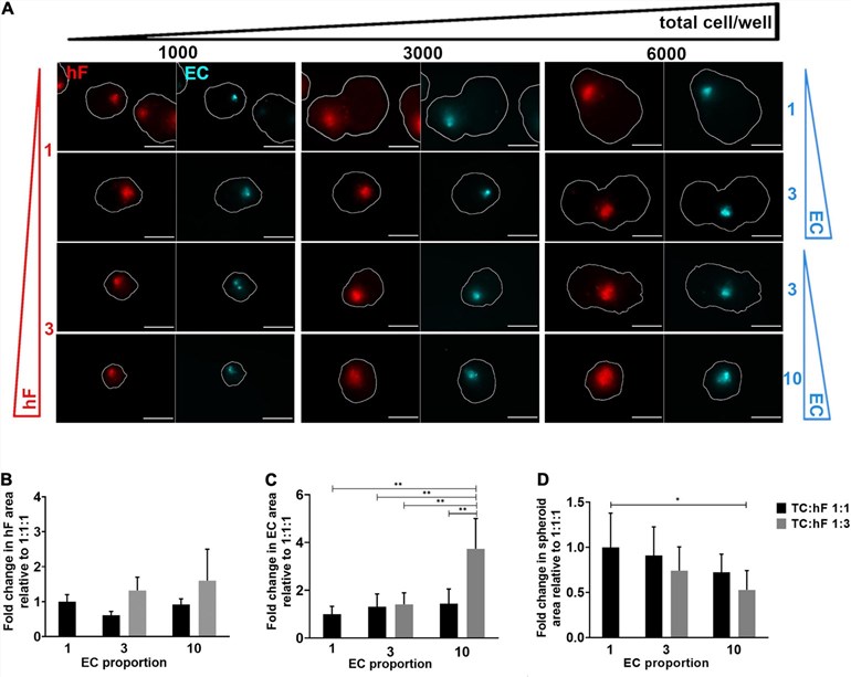 Fig 1. Fluorescence microscopy analysis of breast tumor spheroids with fibroblasts and endothelial cells.