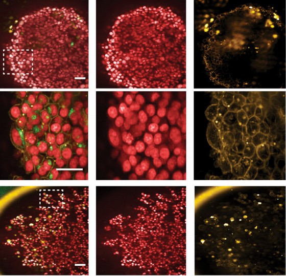 Fig 1. Viral antigens are presented on the cell surface membrane within a tumor spheroid.