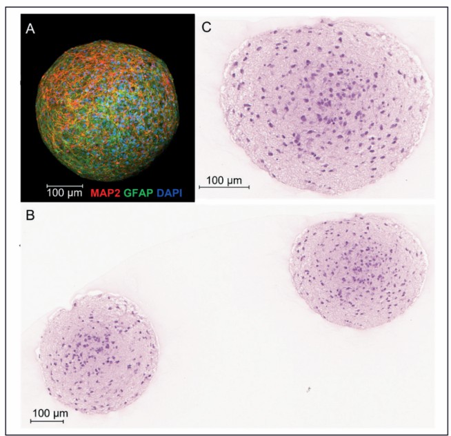 Fig 1. Neural spheroid derived from iPSCs.