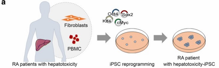 Plan for Producing iPSCs from Healthy Controls and RA Patients with MTX-Induced Hepatotoxicity. 