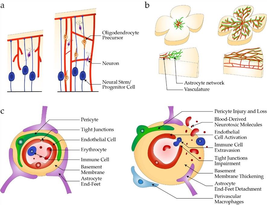 Schematic diagram of the development of the Neurovascular Unit in healthy and diseased people. 