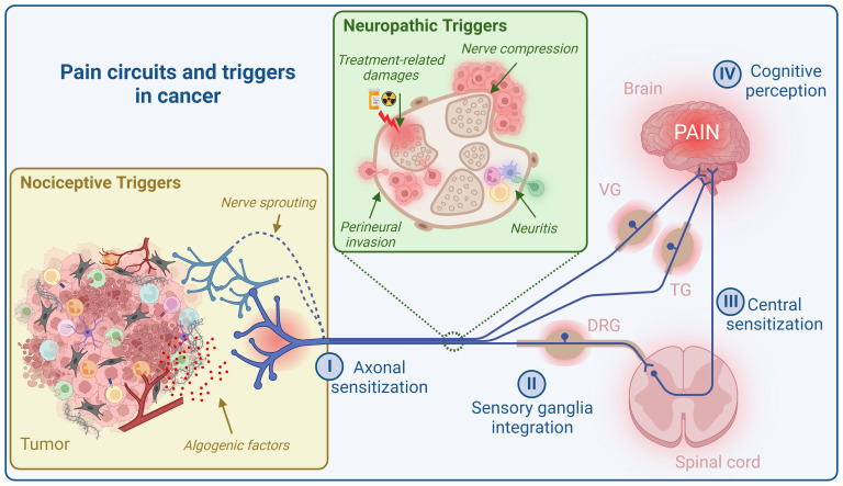 The part that peripheral neurons play in tumor pain circuits.