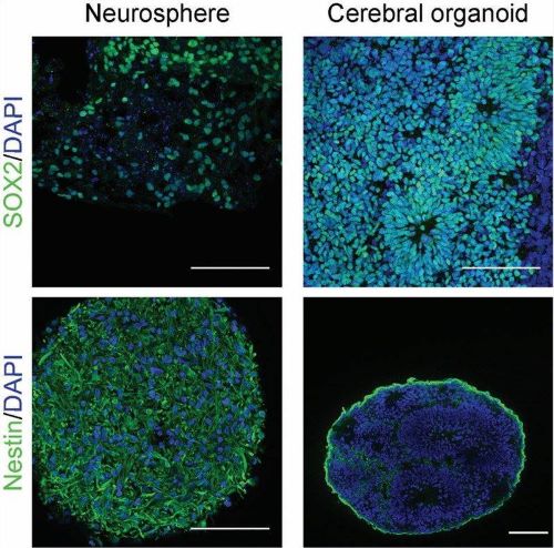Neurospheres and cerebral organoids. (Parmentier, 2023)