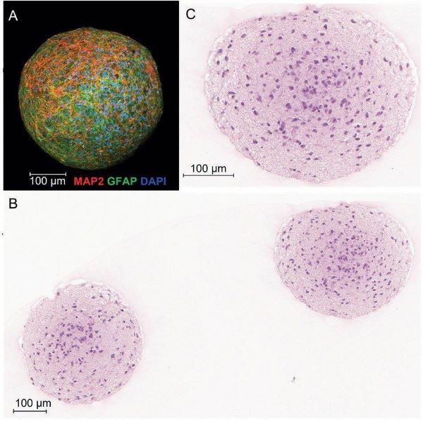 Analysis of images for 3D neural spheroids originated from human iPSCs.