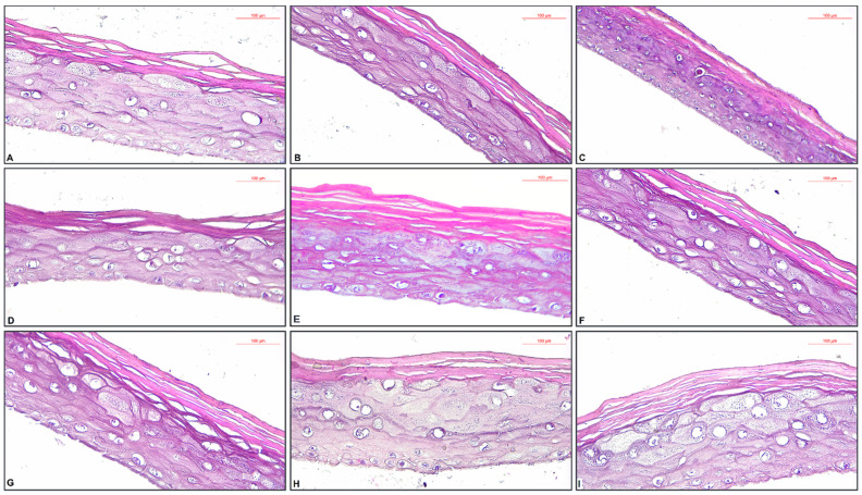 Histological aspects of EpiDerm Phototoxicity Model with the tested oil samples ± UVA treatment.