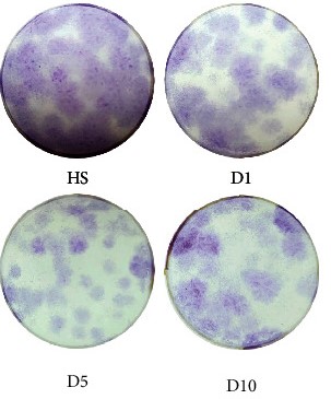 Representative images of CFU-F assays from healthy donors (HS), 1st (D1), 5th (D5), and 10th day (D10) after polytrauma were pooled.