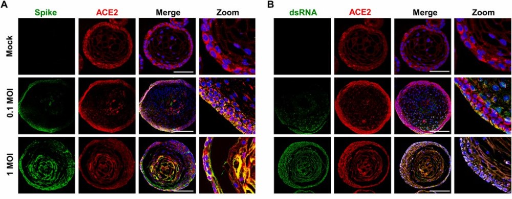Images of immunofluorescent staining for tonsillar epithelial organoids that were infected with diverse virus titers.