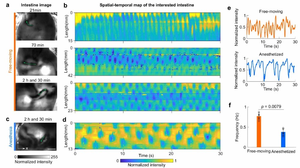 Imaging the Intestinal Motility of Mice through Two-Dimensional Trans-illumination Projection Technique Applied to the Intestine.