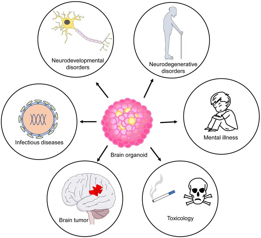 Figure 1 Application of brain organoids as disease models. (OA Literature)