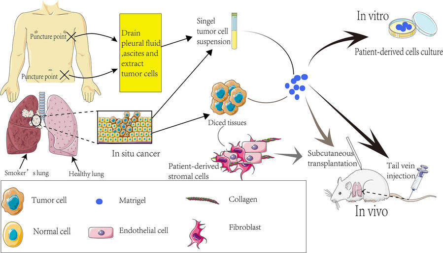 Figure 3 Process of Establishing PDX Models. (OA Literature)
