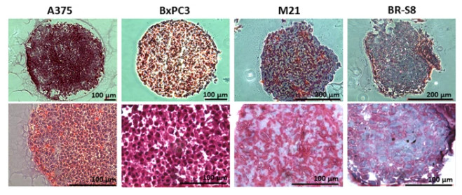 Figure 2: Histological Examination of Collagen Levels in Spheroid Sections. (OA Literature)