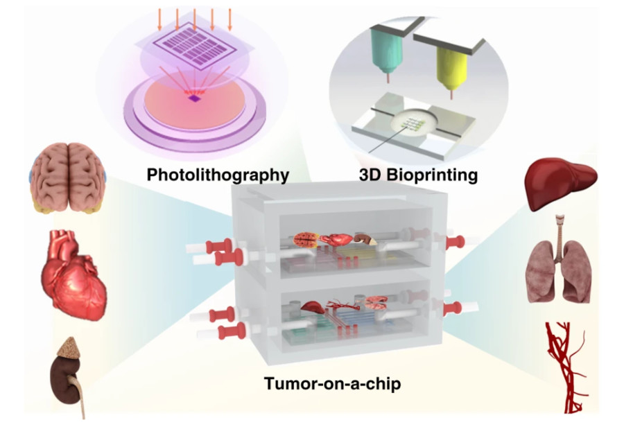 Figure 1 Schematic of a tumor-on-a-chip platform modeling tumor tissue structure and physiological functions in vitro. (OA Literature)