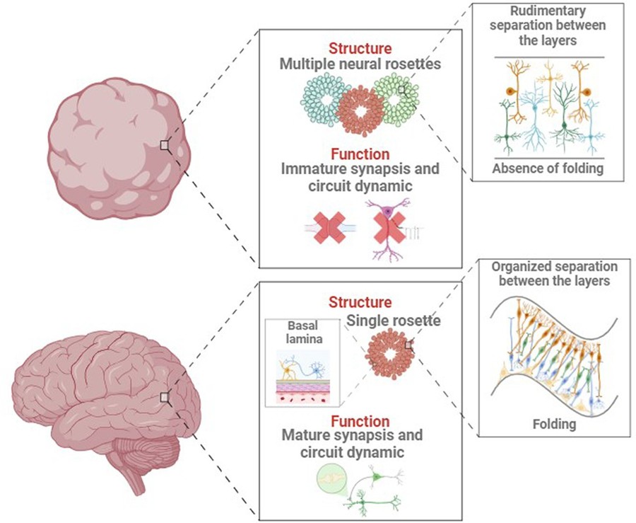 Figure 1: Key structural and functional distinctions between the developing brain in vivo and in vitro, alongside organoid development. (OA Literature)