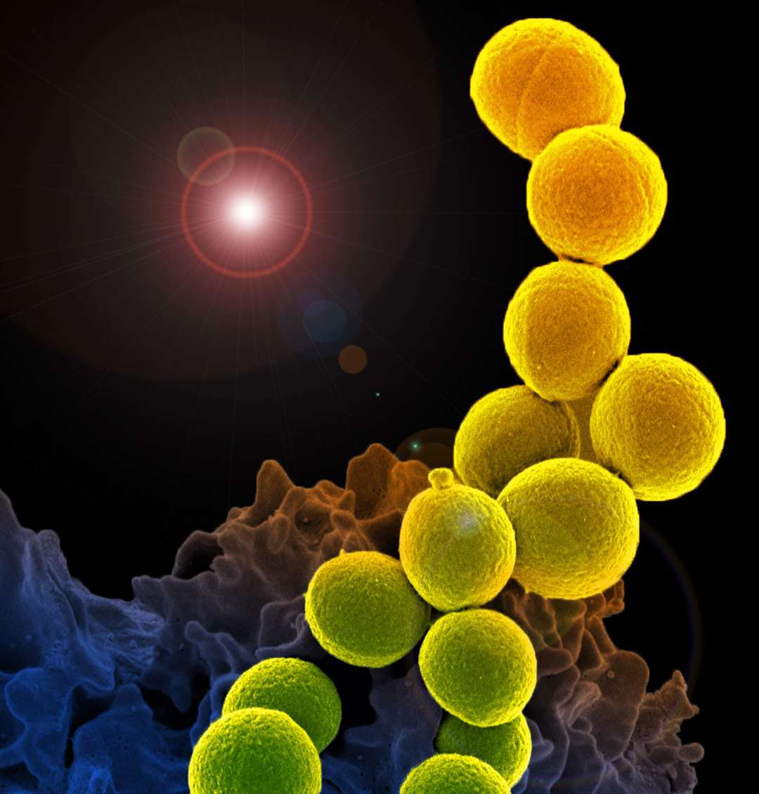 Interaction of a white blood cell with MRSA.