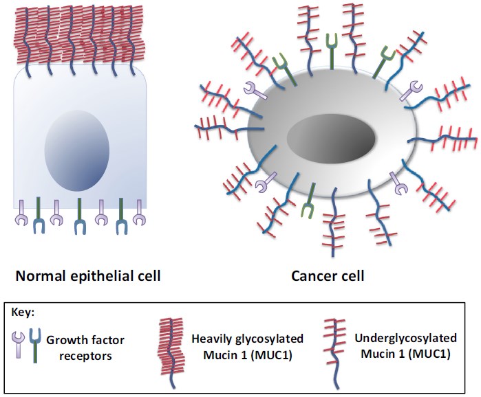 MUC1 overexpression and loss of polarity in cancer cells.
