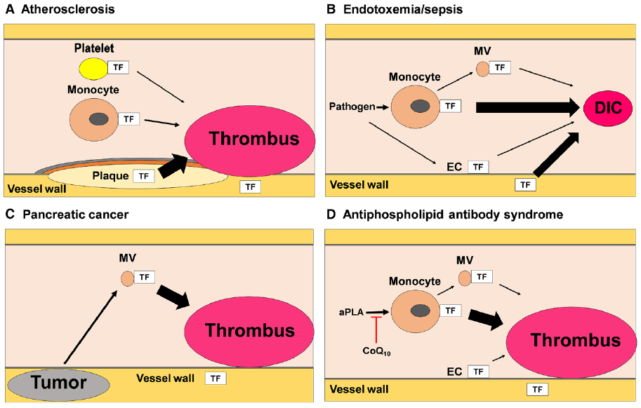 Cellular sources of tissue factor (TF) that trigger thrombosis and disseminated intravascular coagulation.