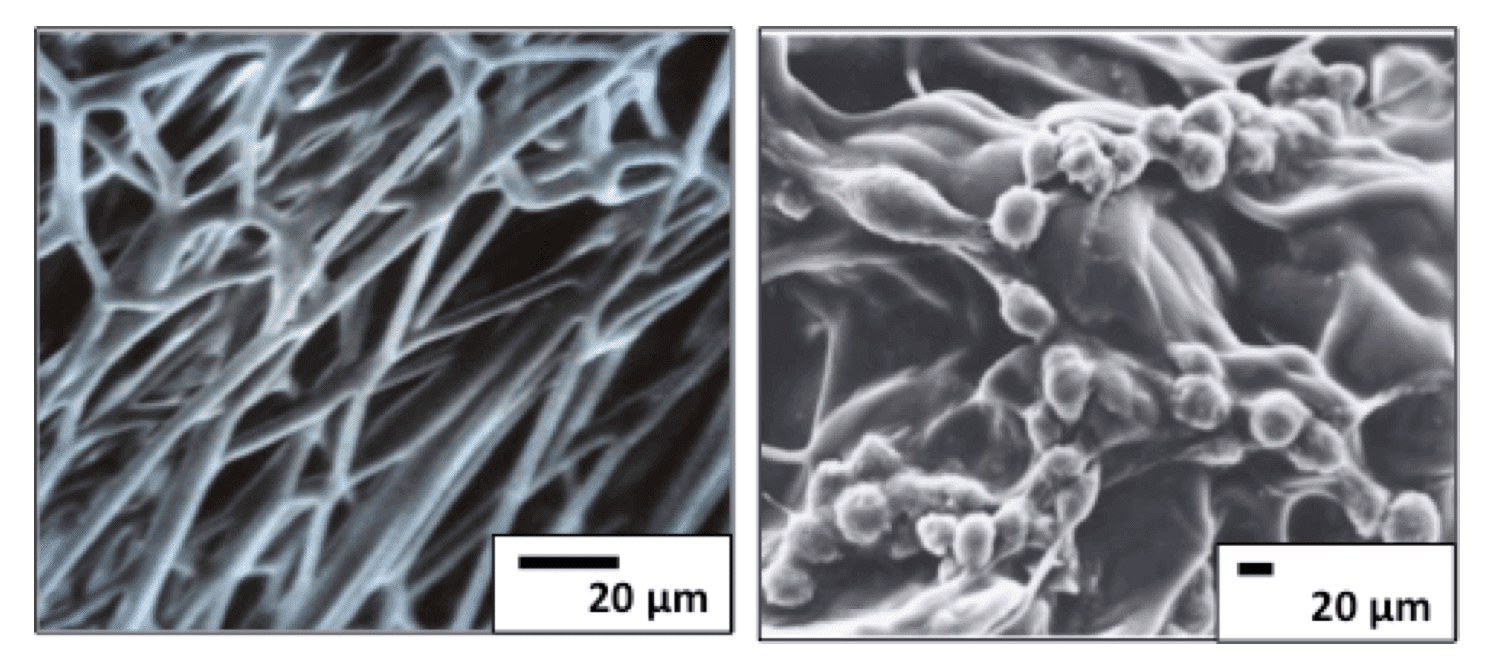 SEM images of the  poly[(R,S)-3-hydroxybutyrate] (aPHB)/ poly[(R)-3-hydroxybutyrate] (PHB) (85/15  w/w) scaffold structure (left) and the 3D aPHB/PHB scaffold settled with human  fibroblasts (right). (<em>Biomed. Mater.
