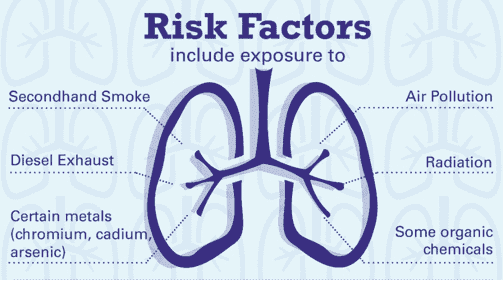 Risk factors of lung cancer.