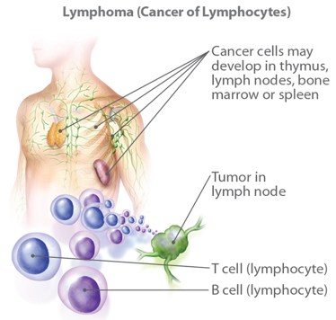 ADC Development for Lymphoma