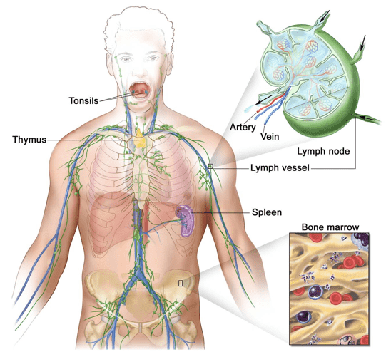  Anatomy of the lymph system, NHL usually originates in lymphoid tissues.