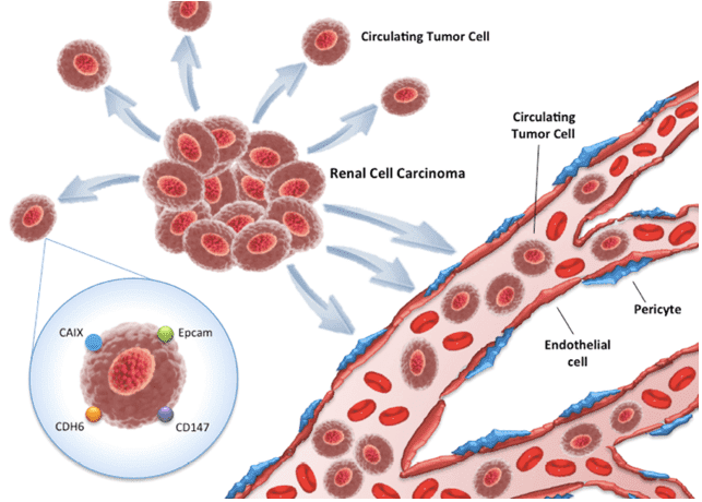 A schematic about circulating tumor cells (CTCs) in the renal cell carcinoma microenvironment. (OA Literature)