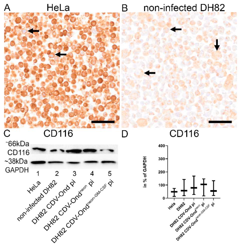 GM-CSF receptor expression. (Marek, et al., 2023) (OA Literature)